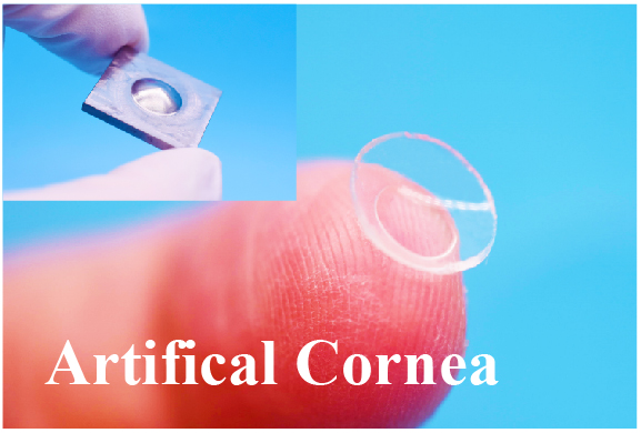 高透光人工角膜（E-Col）